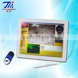 3d Skin Test Skin Analyzer Machine Intelligent thumbnail-1