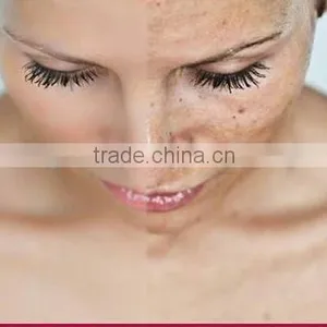 Rf Metal Tube Laser Equipment Spot Scar Pigment Removal Fractional Co2 Laser For Sale Stretch Mark Removal thumbnail-6