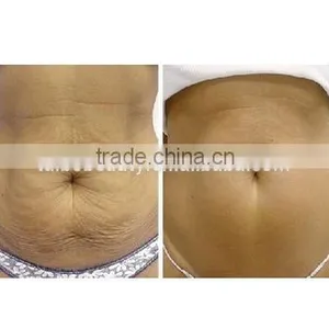 Vertical New 2016 Factory Cryolipolysis Fat Freeze Slimming Machine Slimming Reshaping +lose Weight Machine For Beauty Spa Salon Equipment thumbnail-6