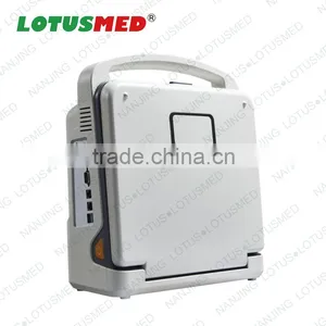 Cheapest LED Display 4D Ultrasound Portable thumbnail-1