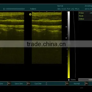 MSLPU25A HOT SALES Digital Best Medical Portable China Portable Ultrasound Machine Price thumbnail-3