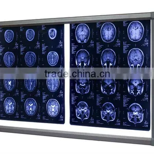 Ultra Silm and High Brightness Medical Light Box thumbnail-1