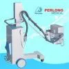 3.5kw Mobile X Ray Equipment| 63mA Medical x Ray Machine (PLX101A ) thumbnail-1