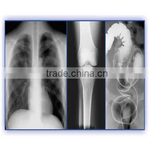 Agfa Film Agfa Dry Films Agfa X-ray Film thumbnail-5