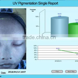 3D Face Scanner/3D Magic Software Magic Mirror Skin Analyzer thumbnail-4