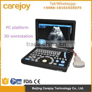 CE Approved Laptop PC Platform 3D Image Ultrasound Machine/Scanner With 3.5Mhz Convex Probe thumbnail-1