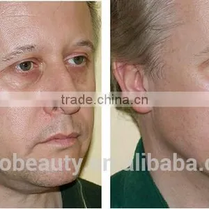 RF Micro Needle Tightening Radio Frequency/RF Skin Lifting Radio Frequency/skin Rejuvenation Radio Frequency thumbnail-6
