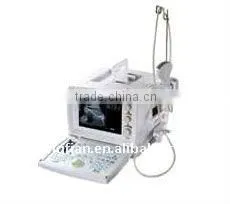 Full Digital Trolley Ultrasound Scanner/ultrsound thumbnail-1