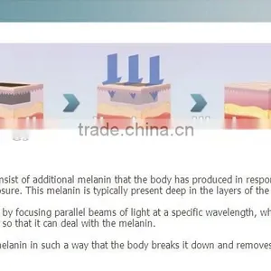 Easy Work Professional Laser Tatoo Removal/Tatoo Removal Machine/Nd YAG Laser CE Q Switched Hair Tatoo Removal thumbnail-6