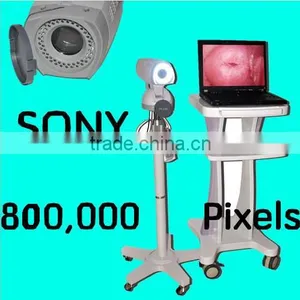Professional Electronic Colposcope SONY Camera CCD 800,000 Pixels for Vulva Vagina Cervis thumbnail-1