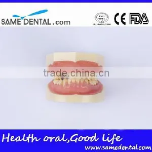 Dental Moderate Periodontal Disease Model Teaching Demonstration thumbnail-3