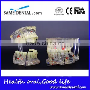 Dental Adult Pathological Dentition Model DEA-48 Teeth Model Teaching Demonstration thumbnail-5