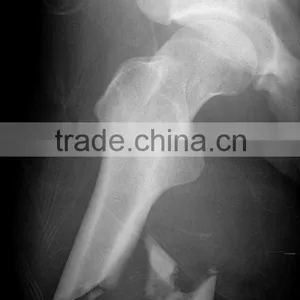 Imaging Medical X-ray Thermal Film,digital X-ray Cr,fuji Dry Film Sale From Factory in Hangzhou thumbnail-1