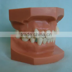 Orthodontic Teeth Model/dental Orthodontic Models thumbnail-2