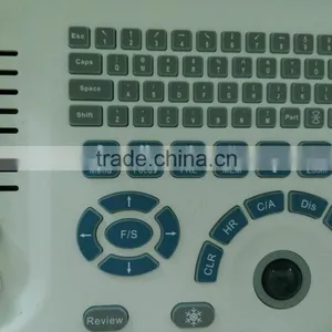 Portable Ultrasonic Diagnostic Devices , Laptop Portable Ultrasound Machine & Ultrasound Scanner thumbnail-2