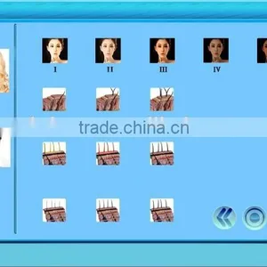GOST-P/ CE Factory Big Promotion New 3 Handles Skin Hair Removal SHR IPL Machine thumbnail-6