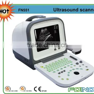 FN551 HOT Selling CE Approved Full Digital Ultrasound Scanner Price thumbnail-1