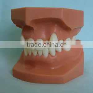 Orthodontic Teeth Model/dental Orthodontic Models thumbnail-3