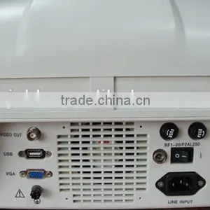 Promotion!!CE Approved Notebook USB Ultrasound Scanner With 3.5Mhz Multi-frequency Convex Probe RUS-6000A thumbnail-4