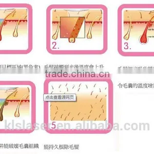 Abdomen 808 Diode Laser Hair Removal Machine Permanent Hair Removal For Men Pigmented Hair thumbnail-5
