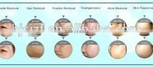 Anybeauty 2 Handpiece Salon Vertical no Pain Ipl SHR Hair Lost Machine / SHR Spare Parts Hair Removal Machine for Sale thumbnail-5