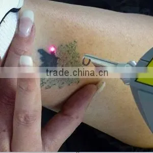 Laser Skin Treatment Machines Laser Ndyag 800mj Tattoo Removal Machine Brown Age Spots Removal thumbnail-2
