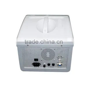 On Sale B Scan Image Portable Ultrasound Scanner Machine Ultrasonic Diagnostic System RUS-6000D With 3.5MHz Convex Probe thumbnail-3