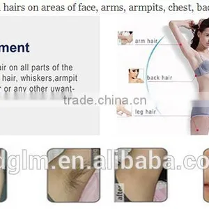 Multifunctional Diode Laser Machine/808nm Diode Laser Adjustable Machine/808nm Diode Laser Hair Removal Machine thumbnail-3
