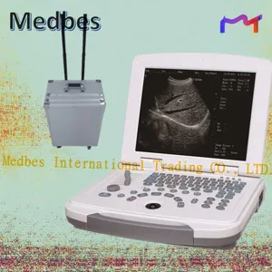 Laptop Black and White Ultrasound SYSTEM thumbnail-1