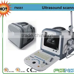FN551 HOT Selling CE Approved Full Digital Chinese Ultrasound Scanners thumbnail-1