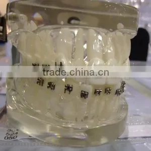 Orthodontic Models/Orthodontic Models Ligature Tying Training Typodont 28 Teeth/Training Techniques Models/dental Orthodontic mo thumbnail-1