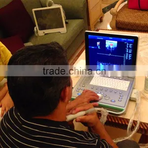 High Quality 3D Color Doppler Ultrasound Machine With Internal Report thumbnail-2