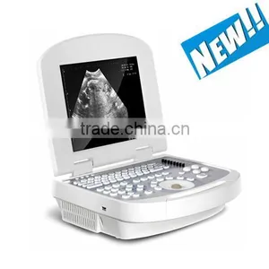 2017 Newest B/W Ultrasound Imaging System 3.5Mhz Convex Probe Laptop Ultrasound Scanner thumbnail-1