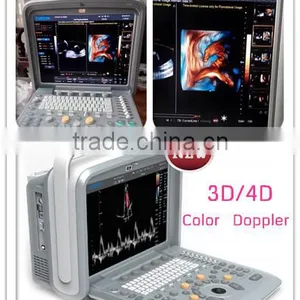 New Laptop/Portable Color Doppler 3D/4D Ultrasound Diagnostic System Machine Q9 thumbnail-1