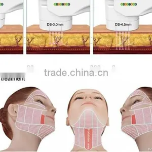 Non-invasive Facial Lifting 13mm for Body Thinner Hifu Vaginal Tighten thumbnail-4