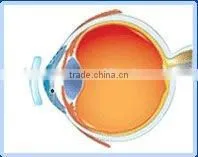 After Laser Surgery/MCT-L/High-end MCT Technology Improve of OK Lenses thumbnail-1