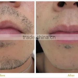 Fast IPL Hair Removal Apolomed HS-620 Portable Ipl Machine thumbnail-6