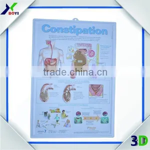 Custom Human Anatomy 3D Embossed Plastic Posters Printing thumbnail-2
