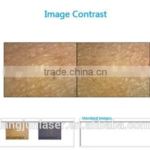 Home, Salons and Clinics Using Portable Skin Tightening Skin Analyzer thumbnail-2