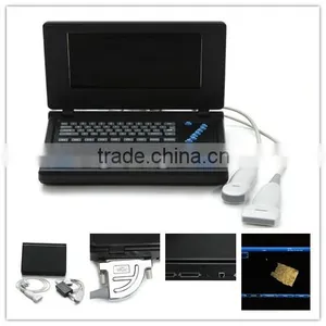 Cardiac Urology Measurement Laptop Ultrasound Scanner for Convex Linear Micro-convex Transvaginal Rectal Probe Option thumbnail-1