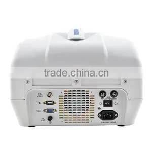 High Quality Portable Veterinary Ultrasound Equipment/portable Diagnostic Ultrasound Price thumbnail-5