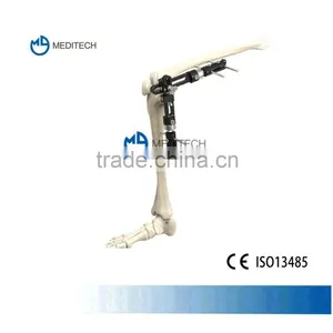 Orthofix External Fixation Orthopedic Surgical Instruments Knee Joint thumbnail-1
