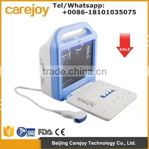 Portable Full Digital Color Doppler Ultrasound Scanner Diagnostic System 2 Probe With Convex Probe and Transvaginal Probe thumbnail-1