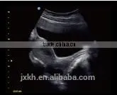 2016 NEW Ultrasound Scanner Color Doppler thumbnail-4