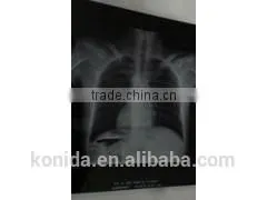 Agfa Film Dt2b 2015 New Product Cheap Dry Film Agfa X-ray Film thumbnail-6
