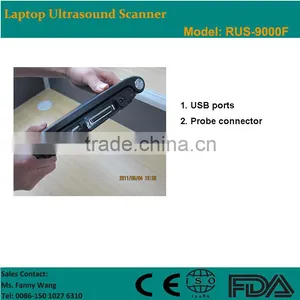 CE Approved Laptop Ultrasound Scanner/Ultrasound Machine With 3.5Mhz Multi-frequency Convex Probe RUS-9000F thumbnail-2