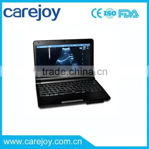 Promotion!!CE Approved Laptop Ultrasound Scanner RUS-9000F With 3.5Mhz Convex Probe and 7.5Mhz Linear Probe thumbnail-1