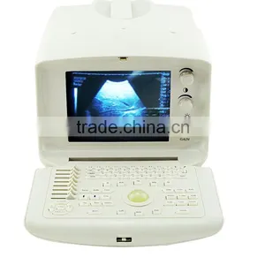 CE ISO Approved One-stop Shopping Service pc Based Ultrasound Scanner Portable Laptop thumbnail-2