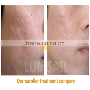 High Quality Skin Care Wrinkle Removal Derma Roller thumbnail-5