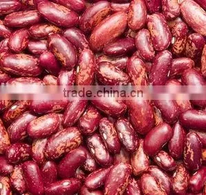 20015 New Crop British Type Dark Red Kidney Beans thumbnail-1